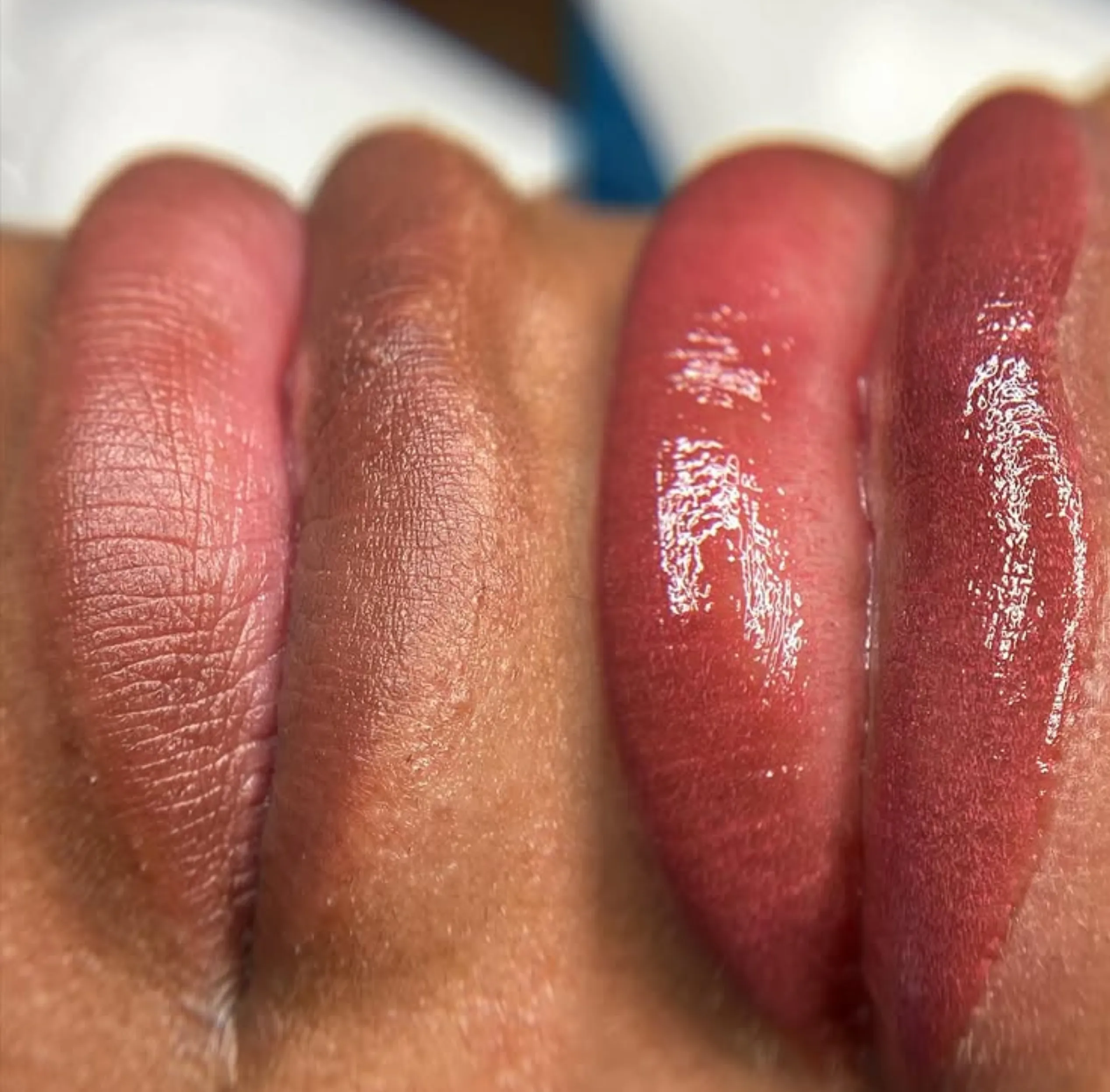 numbing cream patch test