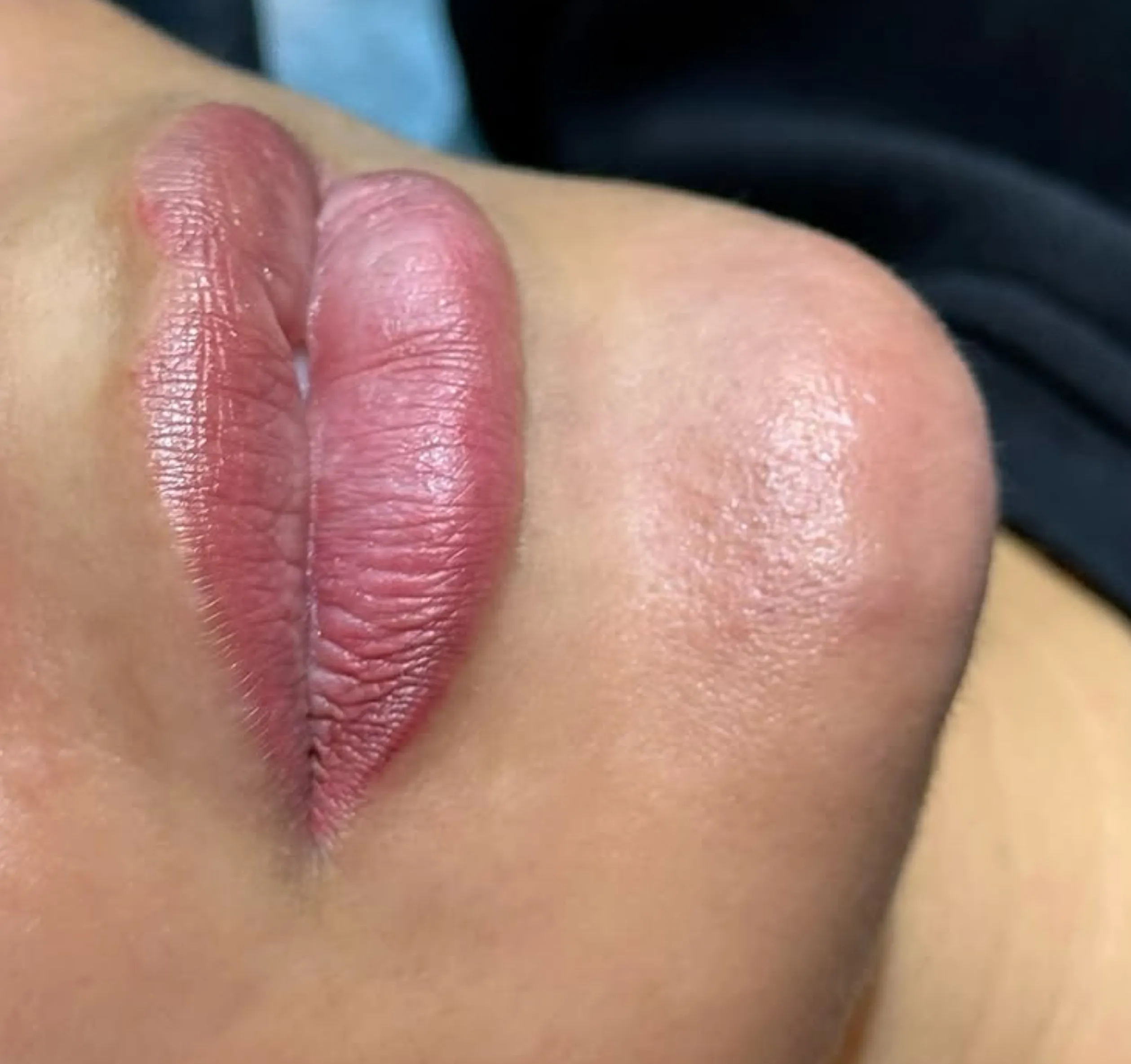 patch test cosmetic tattoo